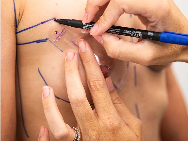 preserve-aumento-pecho-valencia